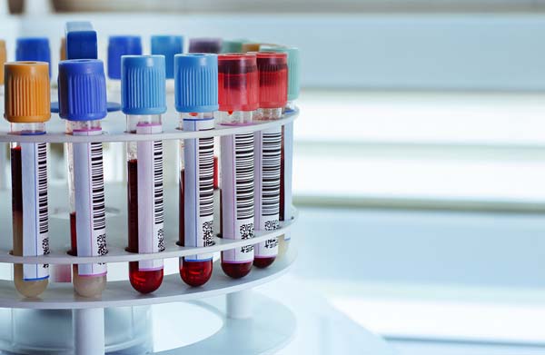 Laboratory Stewardship Starts with Improving Test Utilization