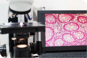 Photo showing a slide image from a microscope projected onto a computer screen.