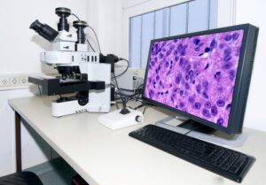 Photo of microscope with a computer screen next to it displaying the slide image.