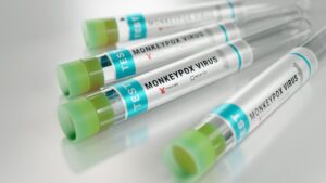Monkeypox virus test tube
