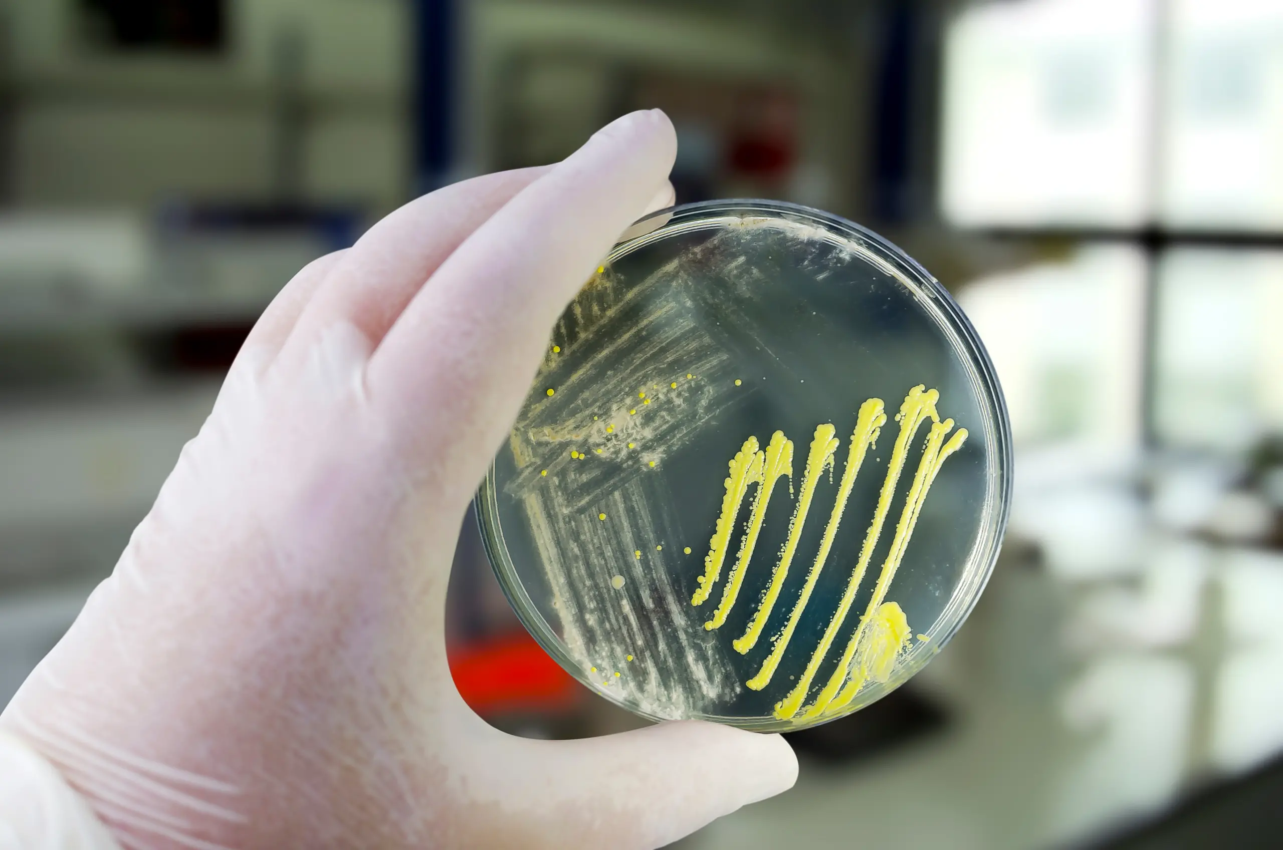 Orchard Integration Supports AUR Reporting for Antimicrobial Stewardship