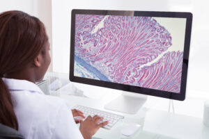 Photo of a lab technician looking at a pathology slide on a computer screen.