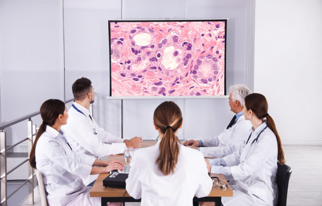 A group of medical professionals sitting around a table looking at a projection screen showing a pathology slide